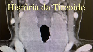 Giulianno Molina De Melo-71