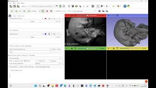 (ELEG5600)Practise paired-point (PP) registration