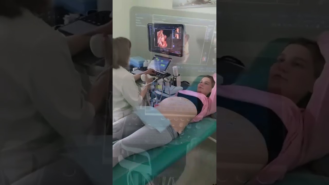 4D Узи #доктор #гармония #узи #беременность #триммеры #4d