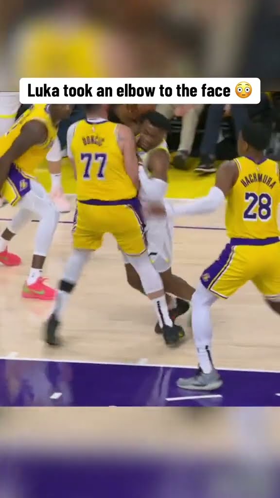 Luka took an elbow to the face ?