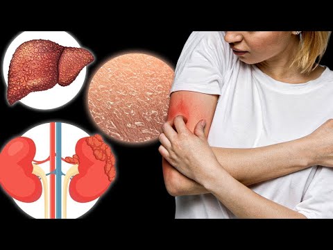 15 Causes of Itching You've Never Heard Of