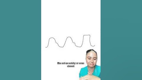 OVER DAMPED ARTERIAL LINE WAVEFORM