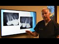 Updated information on root canals and treatments by dr dana rockey