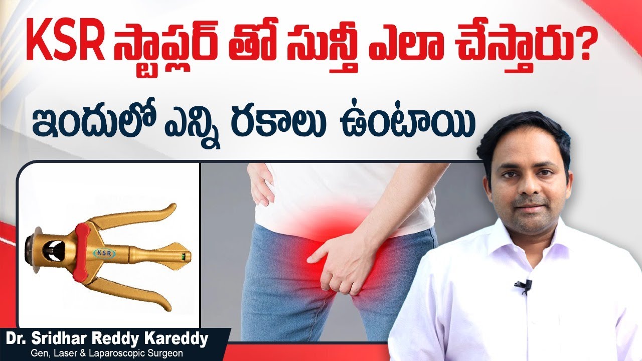 KSR స్టాప్లర్ Types of Stapler Circumcision in Telugu Dr Sridhar