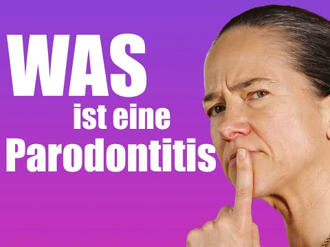 Video: Würde ich wissen, ob ich Parodontose habe?