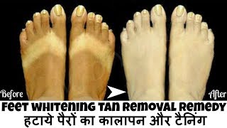 हाथों और पैरों के कालेपन को दूर करने के घरेलू उपाय | Remove Sun Tan from Hands & Feet Quickly