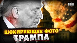 5 минут назад! Трамп ПРИ СМЕРТИ?! На шее президента США обнаружили СТРАННОЕ ПЯТНО. Фото
