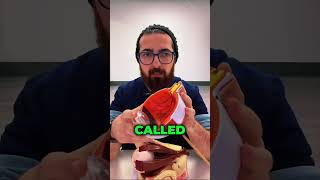 “Can I have BVD even without double vision?” Yes