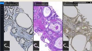 Pathoplatform - Przegląd Funkcjonalności