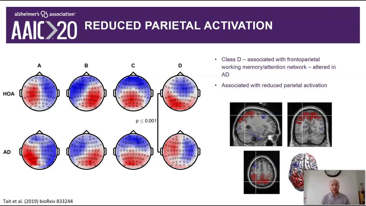 EEG Microstate Complexity for Aiding Early Diagnosis of Alzheimer's Disease (AAIC2020)