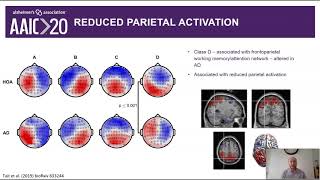 EEG Microstate Complexity for Aiding Early Diagnosis of Alzheimer's Disease (AAIC2020)
