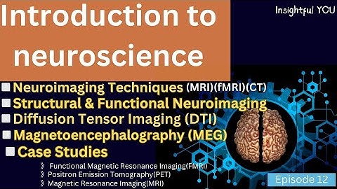 Neuroimaging Techniques #neuroscience #neuroplasticity #psychology #brain