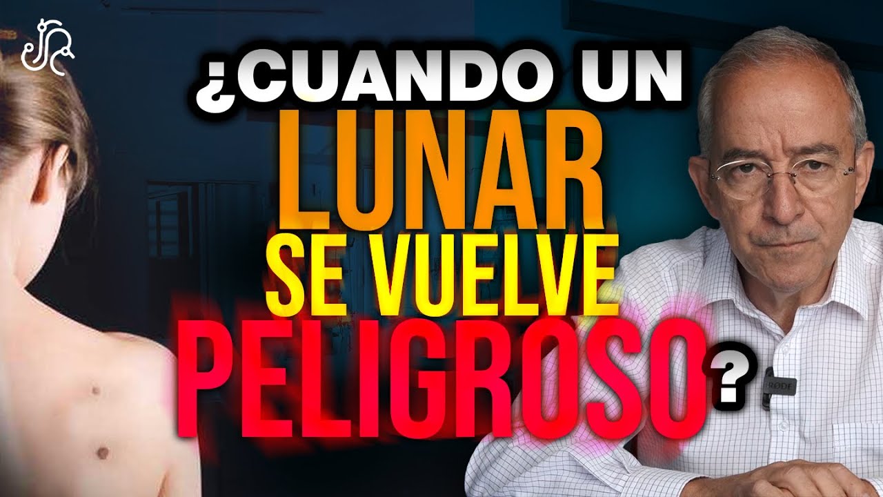 Cuando Un LUNAR Se VUELVE PELIGROSO ? - Oswaldo Restrepo RSC