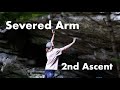 Severed arm 2nd ascent