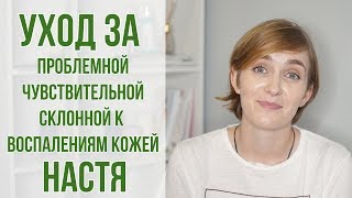 Уход за кожей по-корейски: комбинированная, чувствительная, склонная к воспалениям кожа | OiBeauty