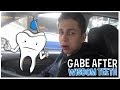 Gabe After Wisdom Teeth