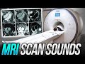 MRI Machine Sounds Inside Scan Room- Cardiac MRI, Heart MRI ASMR