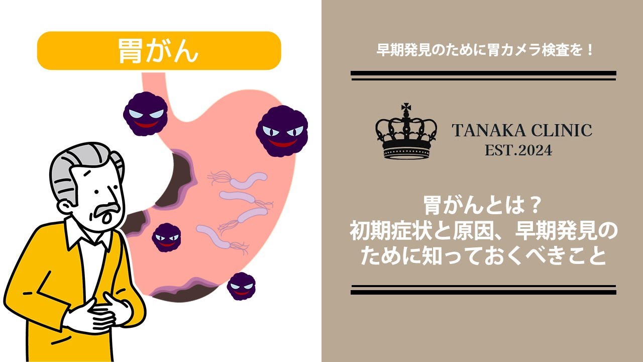 13　胃がんとは？初期症状と原因、早期発見のために知っておくべきこと｜たなか内科クリニック