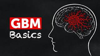What is GBM The Brain Tumor Growing Without Warning