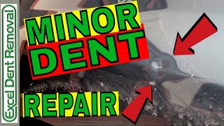 Minor Dent Repair - Paintless Dent Removal Truck Fender by Excel Dent Removal 18,572 views 6 years ago 6 minutes, 7 seconds