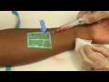 Vein flow can be seen in real time   gigadgets