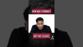 Celebrity How NBA Youngboy got his scars #blackmanyt Net Worth