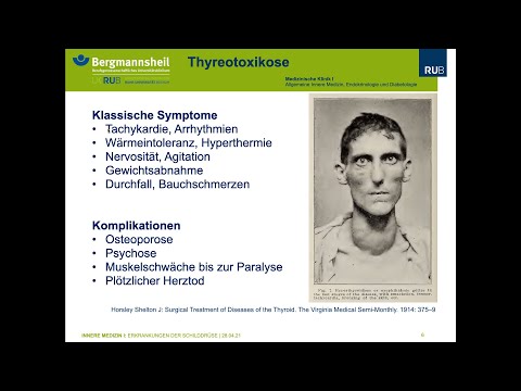 Ruhr-Universität Bochum: Erkrankungen der Schilddrüse (Thyreologie) 2021