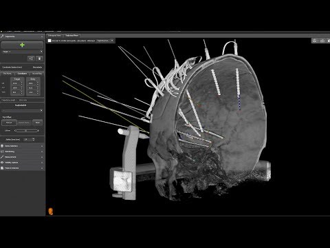 neuroinspire™ surgical planning software for stereotactic procedures