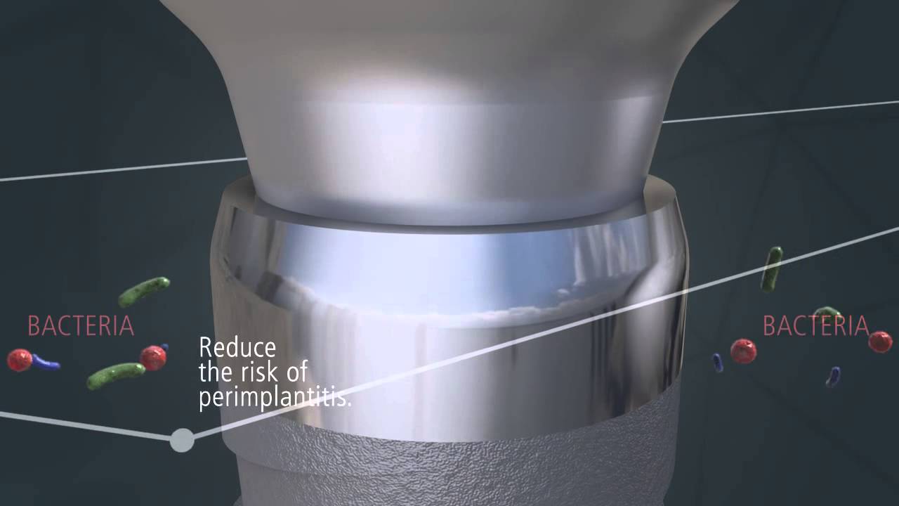 JDICON implant HD