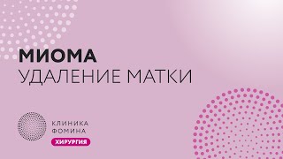 миома: экстирпация матки // лапароскопическая гистерэктомия