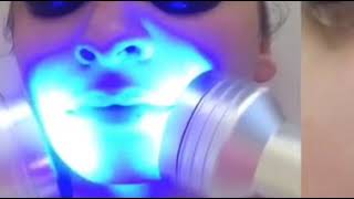 HYDRAFACIAL