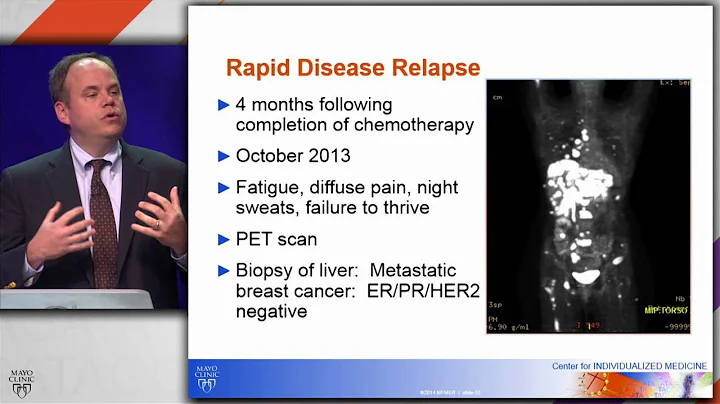 Breast Cancer Genome Guided Therapy (BEAUTY) Study...