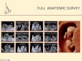 Tips and Tricks to Examining the Midsagittal View at 11-14 Weeks