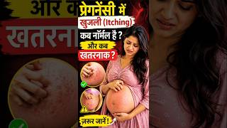 Pregnancy में खुजली NORMAL या खतरे का संकेत? 😨 #pregnancytips#shorts #pregnancy