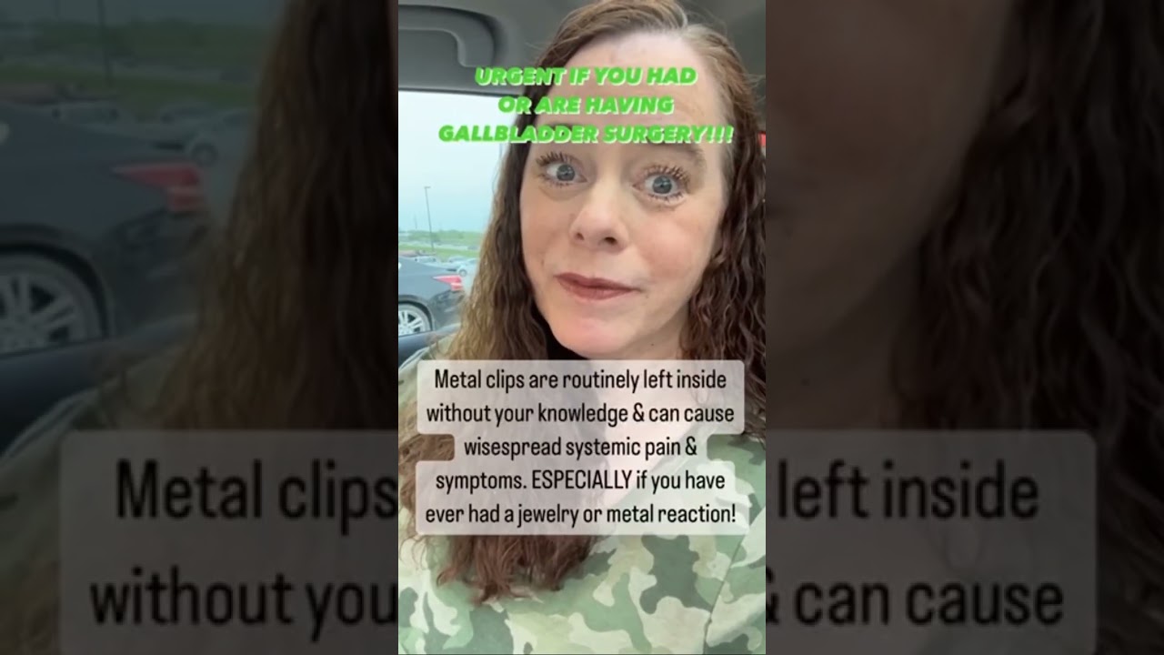 Gallbladder Surgery Warning - Metal Clips Can Cause Systemic Allergic Reaction #metal #allergy