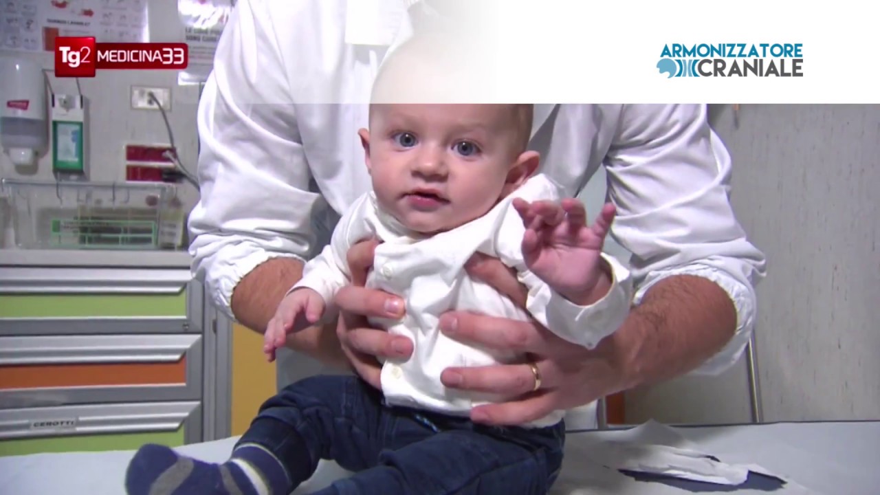 Plagiocefalia: come correggere la testa piatta nei neonati
