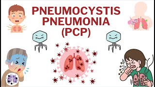 Pneumocystis pneumonia - PCP  #pneumonia #nursing #health #virus #lungs