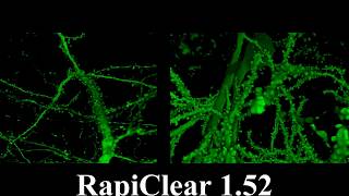 CA1 neurons and a single neuron in mouse brain