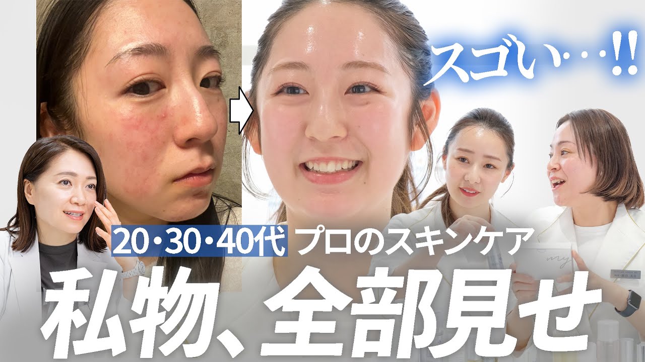 こうなった、やり方教えます。40,30,20代のスキンケア私物持ち寄り