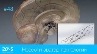 #48 Новости аватар-технологий / Нейроимплант для контроля экзоскелета силой мысли