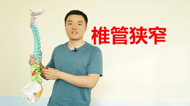 腰腿痛，懷疑椎管狹窄？如何快速自查？醫學示例簡單2招，緩解疼痛 - 天天要聞