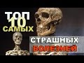 ТОП 10  САМЫЕ СТРАШНЫЕ БОЛЕЗНИ человечества ШОК!