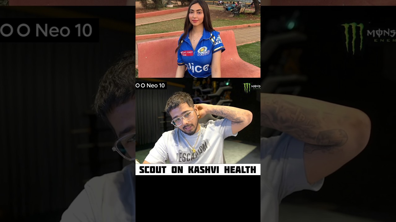 SCOUTOP ON KASHVI TUMOR 