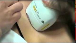 Laser Hair Removal Intense Pulsed Light Sherman Oaks 87