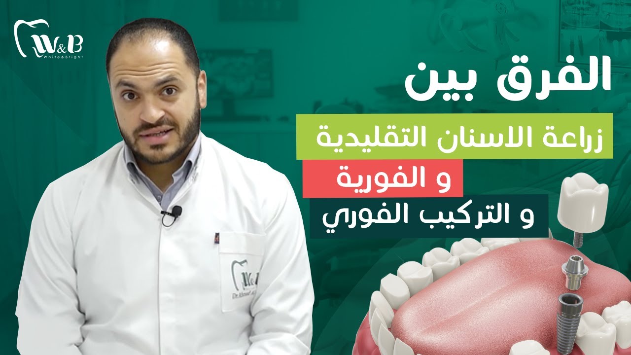 مراحل و خطوات زراعة الأسنان (التقليدية و الفورية و التركيب الفوري