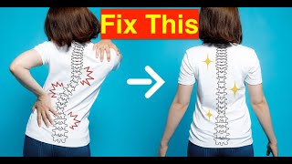 Slipped Disc Signs, Treatment and Exercises | Back Pain | Herniated Disc