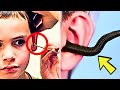 Kid Goes To Hospital Because Of A Pencil Stuck In His Ear - DOCTORS FIND SOMETHING MORE DANGEROUS