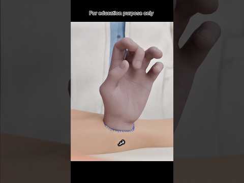 الدكتور خيط إيد حماصة في رجليه 