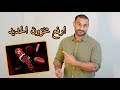 السبب الحقيقي وراء نقص مخزون الحديد وطرق تعويضه