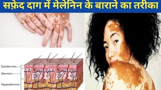 How to Increase Melanin Naturally in Hindi | मेलेनिन को कैसे बढ़ाये?| Vitiligo Treatment